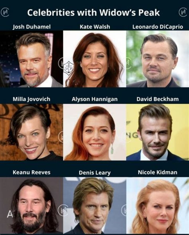 Celebrities with Widows Peaks You May Have Never Noticed Before