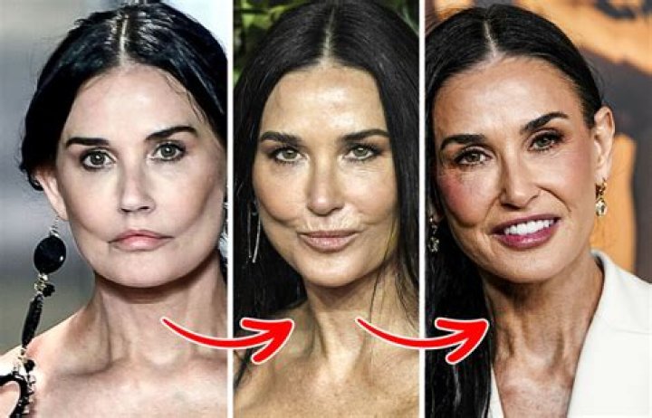 Did Demi Moore Get Plastic Surgery? Her Fendi Runway Walk Had People Worried