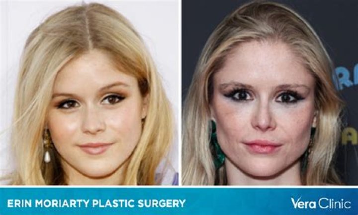 Truth About Stephanie Beatrizs Plastic Surgery Rumors