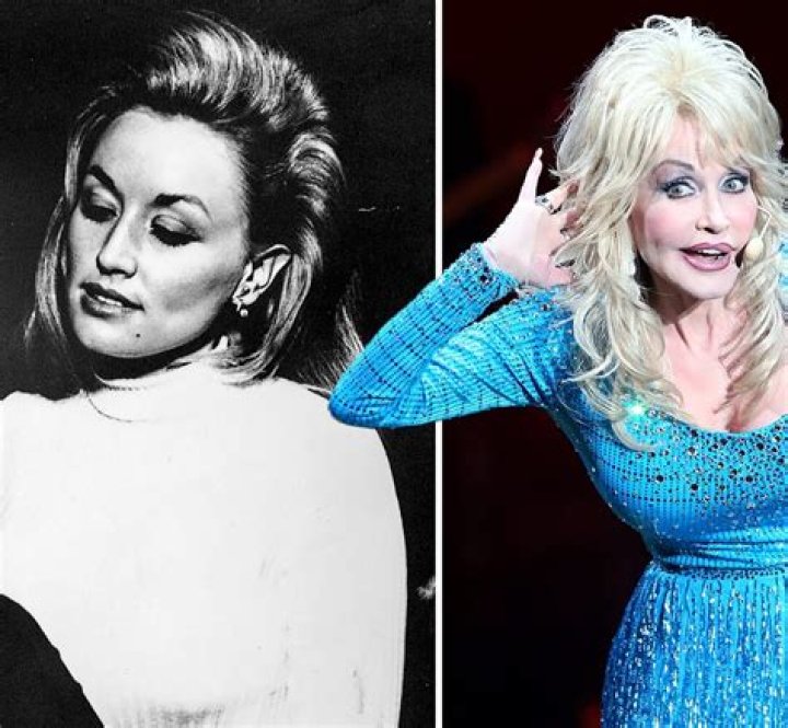 Unveiling The "Dolly Without Wig" Aesthetic: Discoveries And Insights